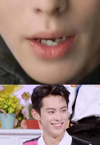开云体育官方网站-王鹤棣整牙惊艳众人三三口腔助你开启笑容焕新之旅